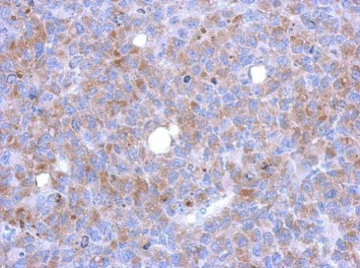 ASAP3 Antibody in Immunohistochemistry (Paraffin) (IHC (P))