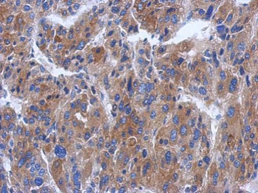 CWF19L1 Antibody in Immunohistochemistry (Paraffin) (IHC (P))