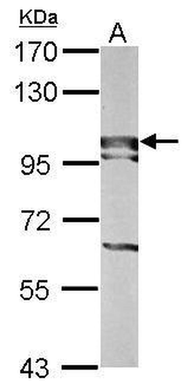 BOP1 Antibody in Western Blot (WB)