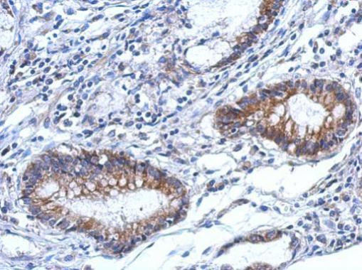 TARS2 Antibody in Immunohistochemistry (Paraffin) (IHC (P))