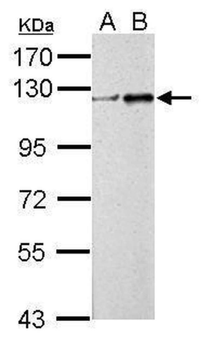 ZNF711 Antibody in Western Blot (WB)