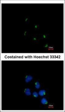 GCC1 Antibody in Immunocytochemistry (ICC/IF)