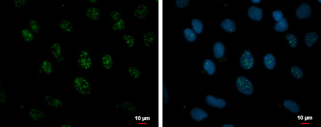 RSRP1 Antibody in Immunocytochemistry (ICC/IF)