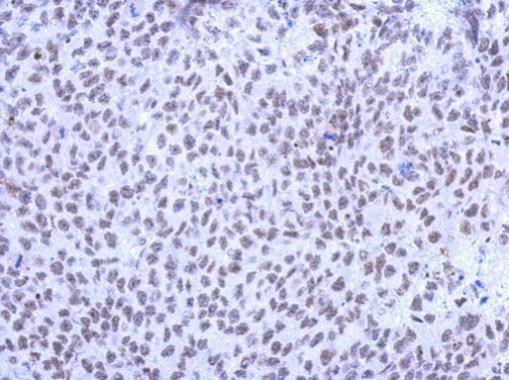 KLHL13 Antibody in Immunohistochemistry (Paraffin) (IHC (P))
