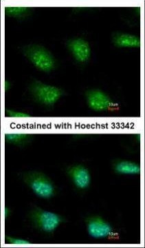 KIAA0323 Antibody in Immunocytochemistry (ICC/IF)