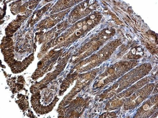 SNX27 Antibody in Immunohistochemistry (Paraffin) (IHC (P))