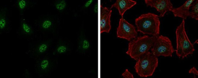 RBM26 Antibody in Immunocytochemistry (ICC/IF)