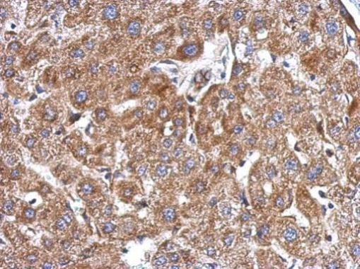 KCTD3 Antibody in Immunohistochemistry (Paraffin) (IHC (P))