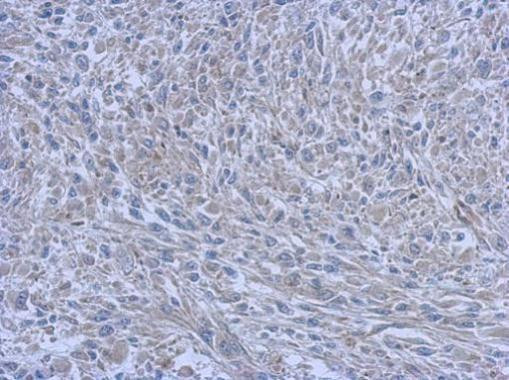 FCHO1 Antibody in Immunohistochemistry (Paraffin) (IHC (P))