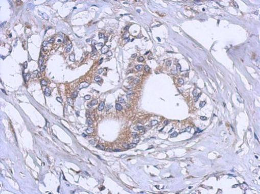RPL12 Antibody in Immunohistochemistry (Paraffin) (IHC (P))