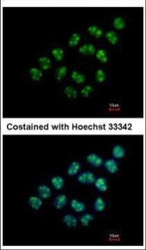 Nop25 Antibody in Immunocytochemistry (ICC/IF)