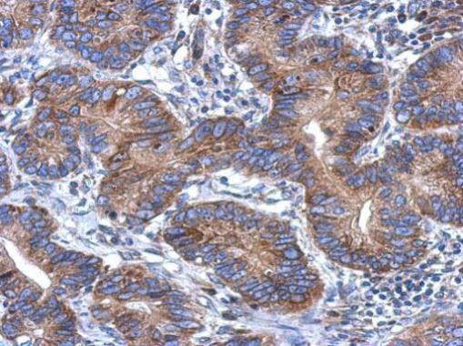 CCDC70 Antibody in Immunohistochemistry (Paraffin) (IHC (P))