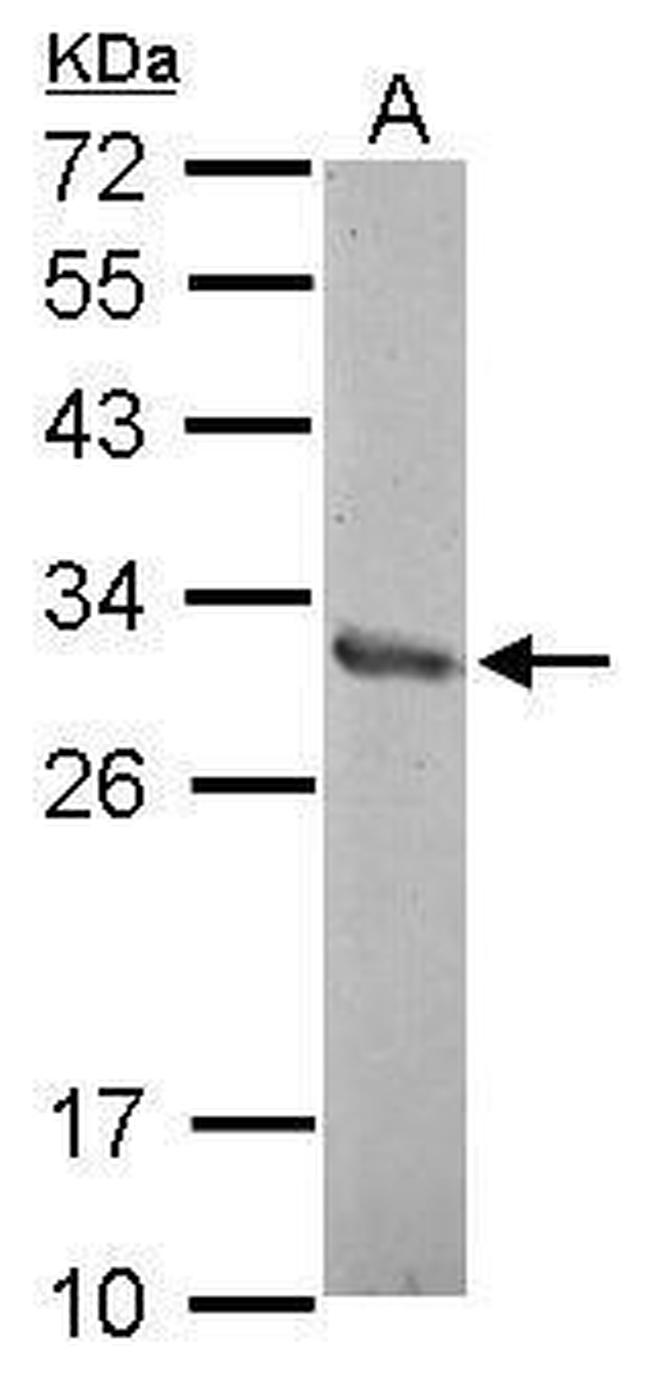 ZNF414 Antibody in Western Blot (WB)