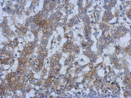 SPRYD5 Antibody in Immunohistochemistry (Paraffin) (IHC (P))