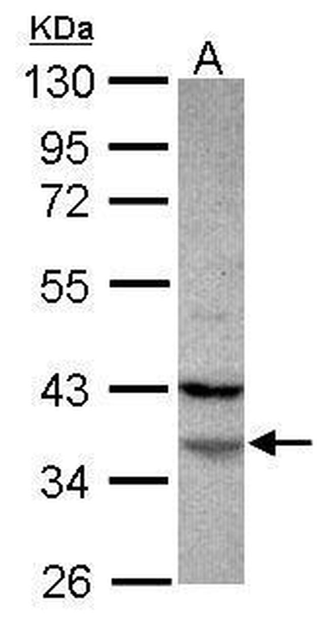 FAM76A Antibody in Western Blot (WB)