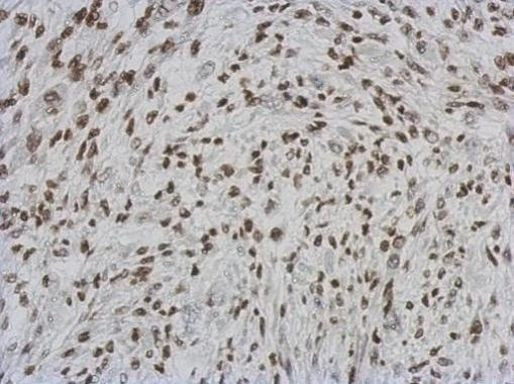 RASSF4 Antibody in Immunohistochemistry (Paraffin) (IHC (P))