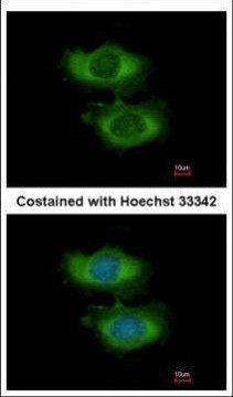 NAA16 Antibody in Immunocytochemistry (ICC/IF)