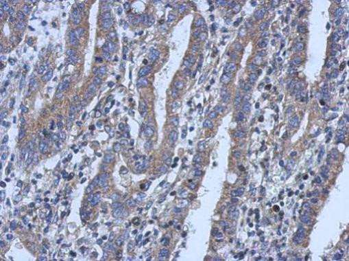 LYPLA3 Antibody in Immunohistochemistry (Paraffin) (IHC (P))