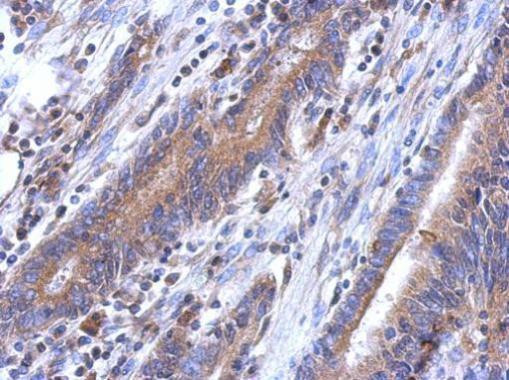 LYPLA3 Antibody in Immunohistochemistry (Paraffin) (IHC (P))