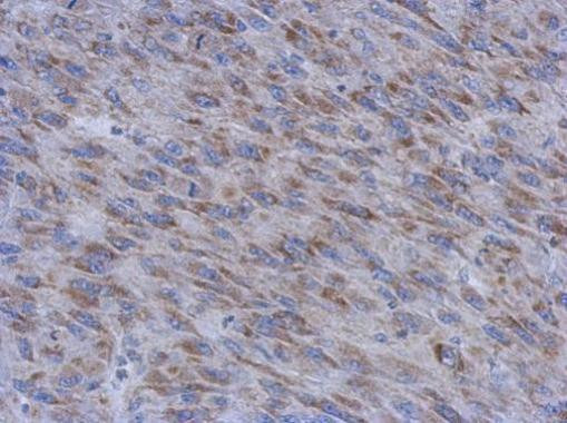 MUM1L1 Antibody in Immunohistochemistry (Paraffin) (IHC (P))