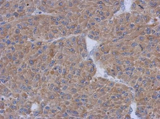 CCDC17 Antibody in Immunohistochemistry (Paraffin) (IHC (P))