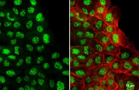 CREB3L3 Antibody in Immunocytochemistry (ICC/IF)