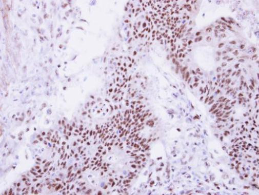 DDX47 Antibody in Immunohistochemistry (Paraffin) (IHC (P))
