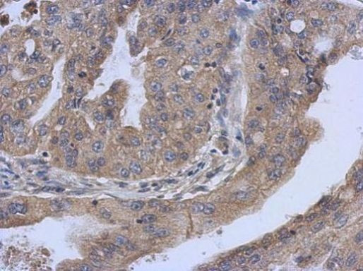 COQ6 Antibody in Immunohistochemistry (Paraffin) (IHC (P))
