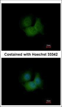 FBXL16 Antibody in Immunocytochemistry (ICC/IF)