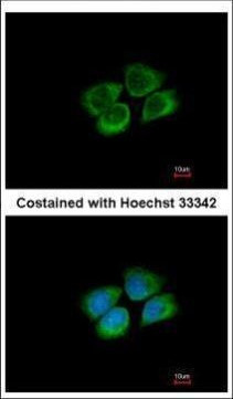 PARS2 Antibody in Immunocytochemistry (ICC/IF)