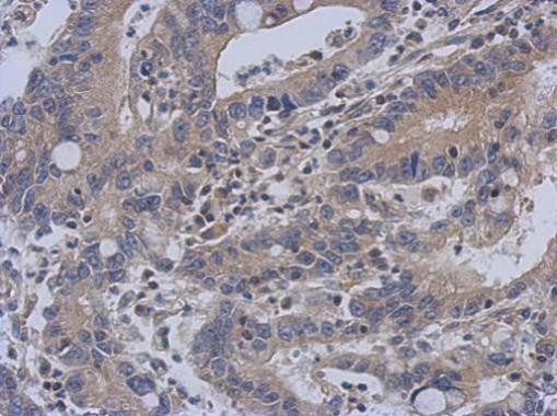 C14orf21 Antibody in Immunohistochemistry (Paraffin) (IHC (P))