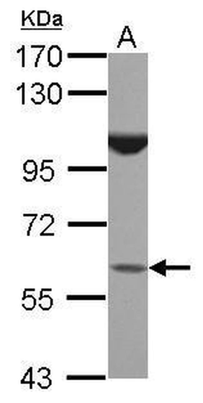BTBD16 Antibody in Western Blot (WB)