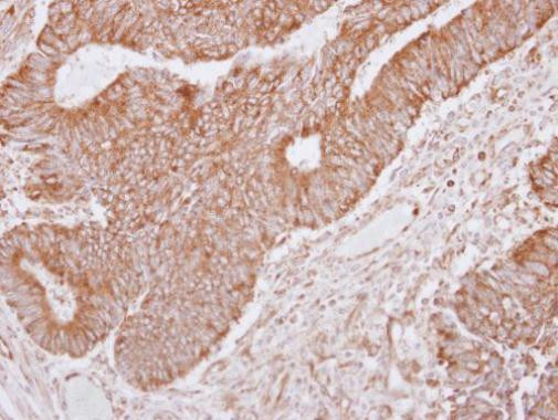 Lano Antibody in Immunohistochemistry (Paraffin) (IHC (P))