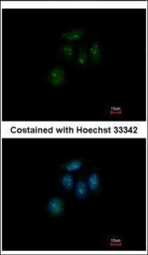 ZFP69 Antibody in Immunocytochemistry (ICC/IF)