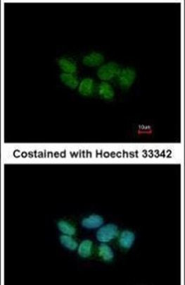 PHACTR3 Antibody in Immunocytochemistry (ICC/IF)