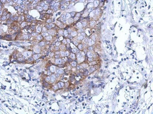 DDX59 Antibody in Immunohistochemistry (Paraffin) (IHC (P))