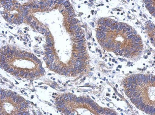 ENTPD7 Antibody in Immunohistochemistry (Paraffin) (IHC (P))