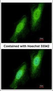 TRIM41 Antibody in Immunocytochemistry (ICC/IF)