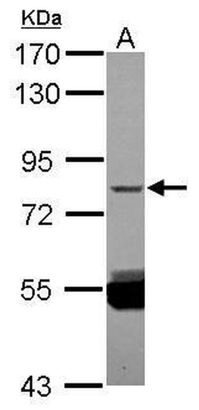 ZNF280C Antibody in Western Blot (WB)