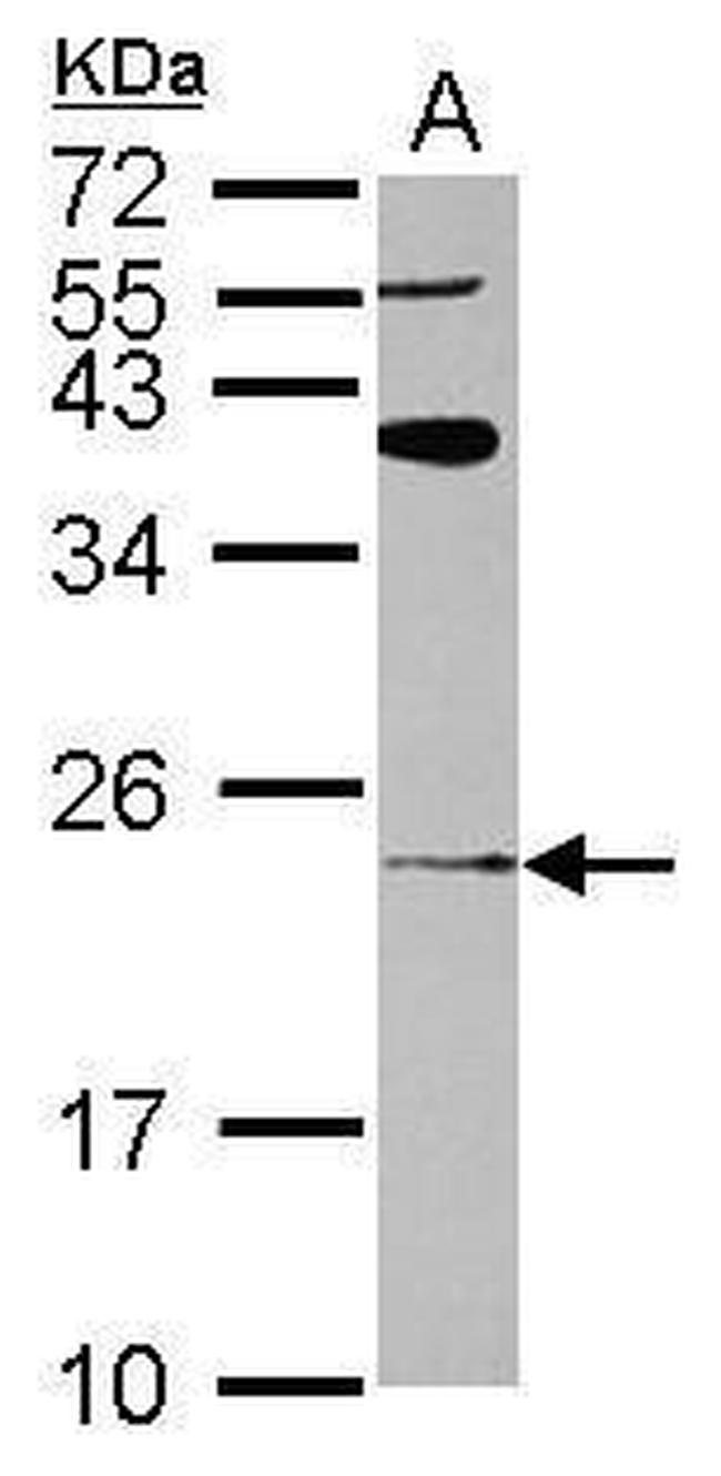 ARL8A Antibody in Western Blot (WB)