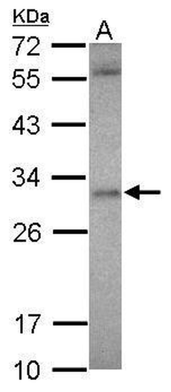 ASB12 Antibody in Western Blot (WB)