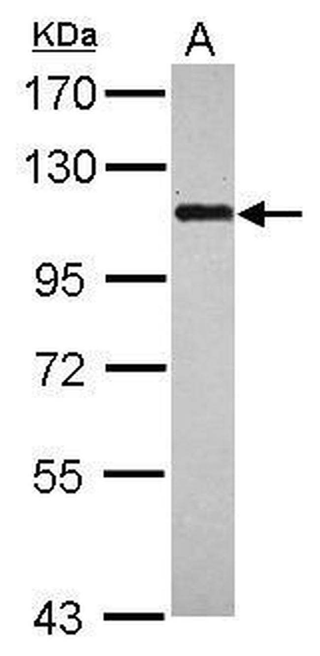 BOP1 Antibody in Western Blot (WB)