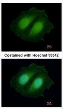 CBWD1 Antibody in Immunocytochemistry (ICC/IF)