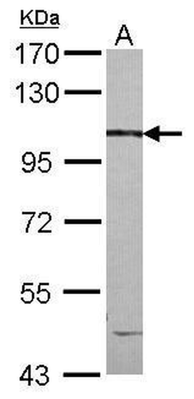 CCDC147 Antibody in Western Blot (WB)
