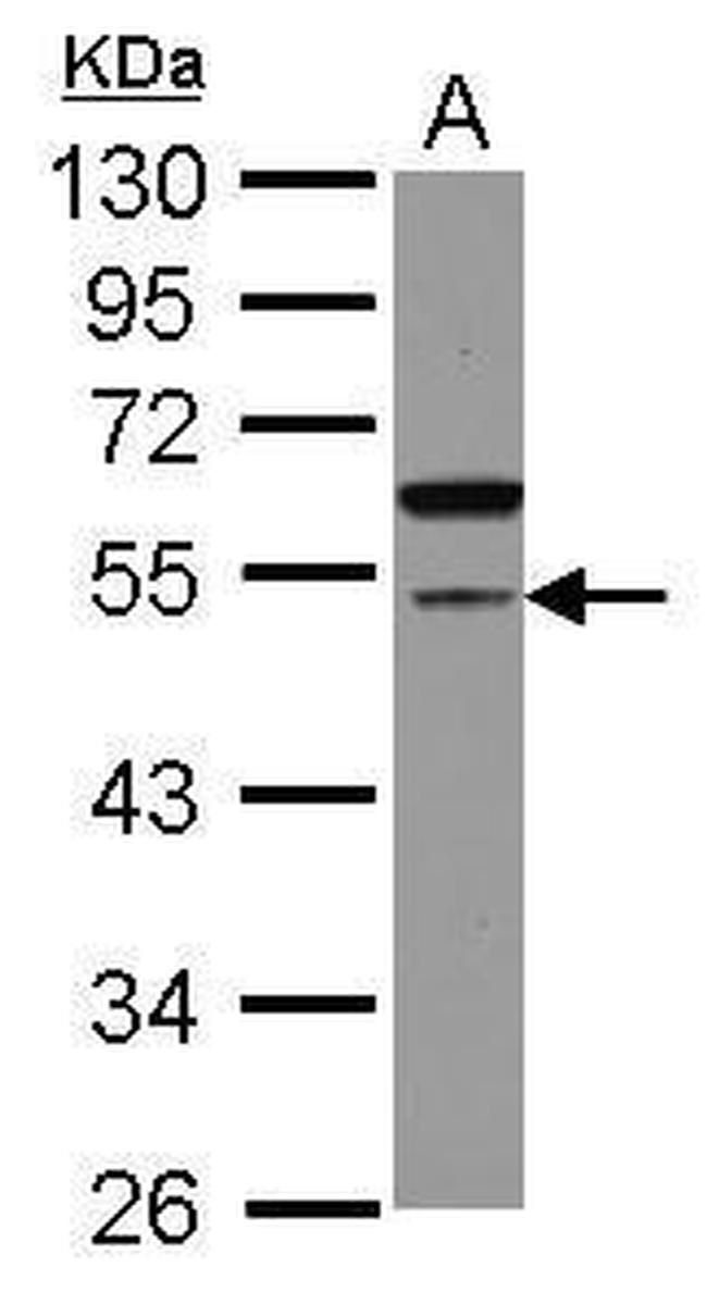 CDCA7L Antibody in Western Blot (WB)