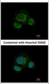 CHST7 Antibody in Immunocytochemistry (ICC/IF)