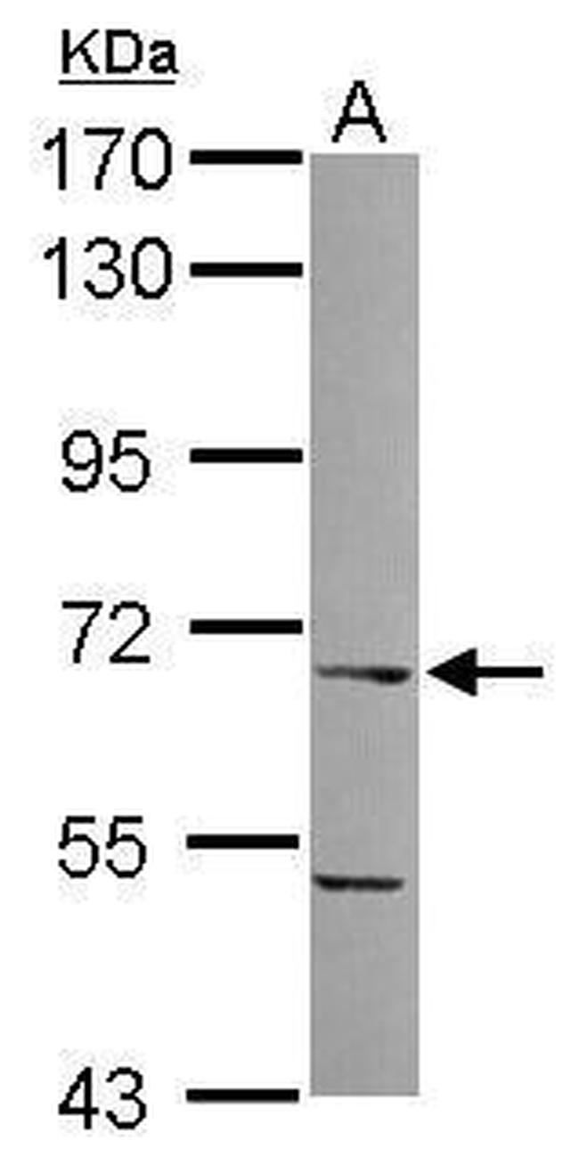ITPRIPL1 Antibody in Western Blot (WB)