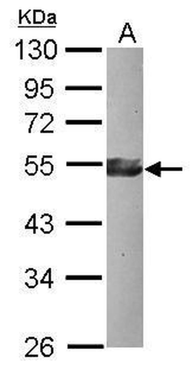 KLF17 Antibody in Western Blot (WB)