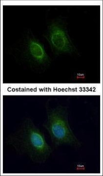 Cytokeratin 36 Antibody in Immunocytochemistry (ICC/IF)