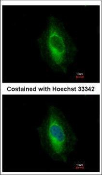 EPLIN Antibody in Immunocytochemistry (ICC/IF)